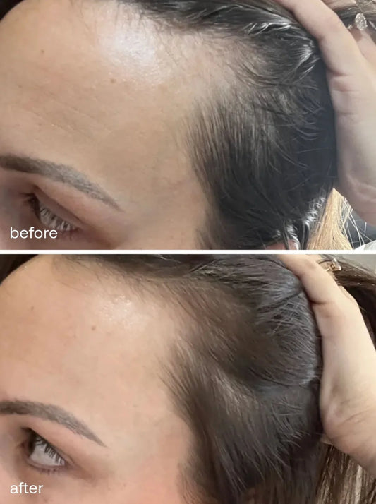 UKHAIR Hair Growth Serum - 50ml