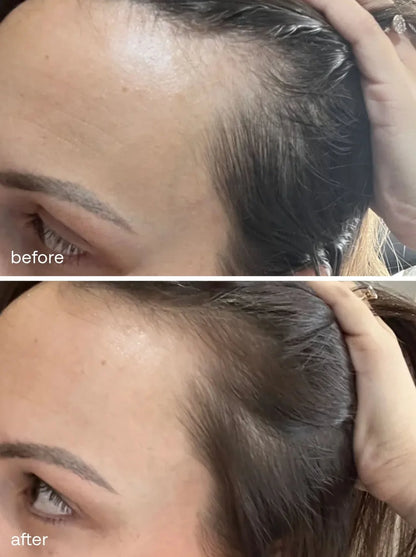 UKHAIR Hair Growth Serum - 30ml