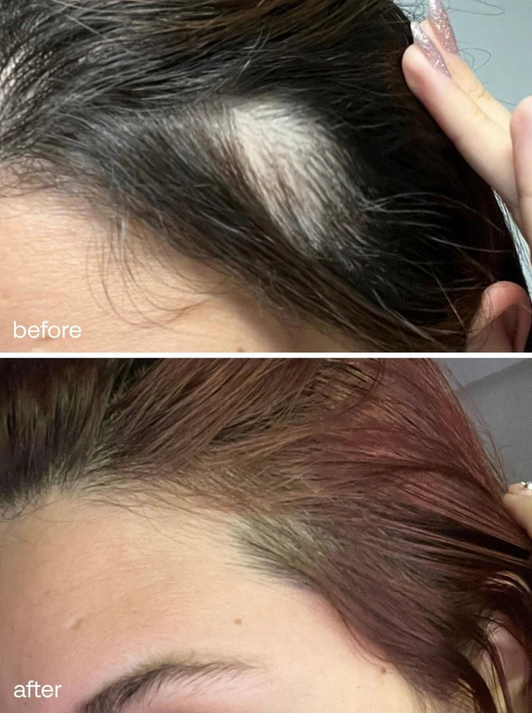 UKHAIR Scalp Massager